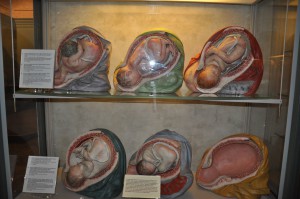 Three-dimensional wax models, featured in the Palazzo Poggi Museum,  depicting babies developing in the womb .